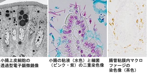 小腸上皮細胞の透過型電子顕微鏡像／小腸の粘液（水色）と細菌（ピンク・紫）の二重染色像／腸管粘膜内マクロファージの染色像（茶色）